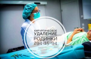 Хирургическое удаление родинки (невуса)